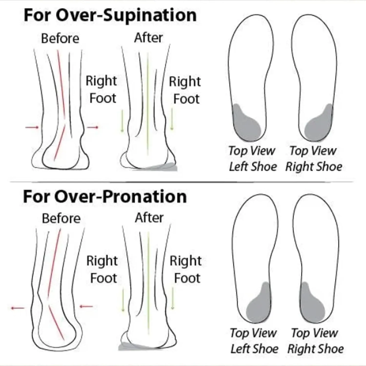 Women's Soft Sole Mesh Comfort Orthopedic Shoes, Comfortable Walking Shoes Women Arch Support, Casual Slip-on Shoes, Low-top Flat Arch Support Walking Shoes